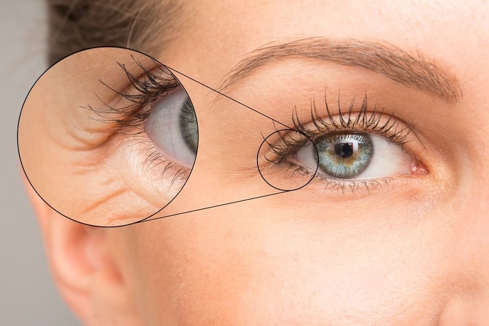 What is Oculoplasty? Procedures, Benefits & Recovery