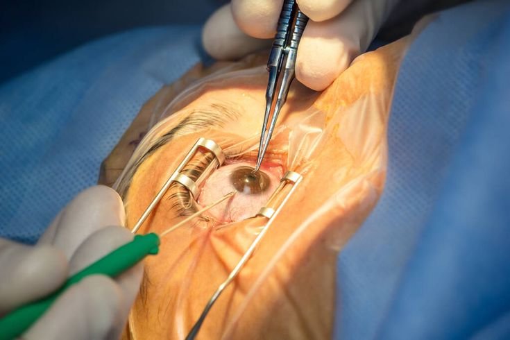 What is Oculoplasty? Procedures, Benefits & Recovery