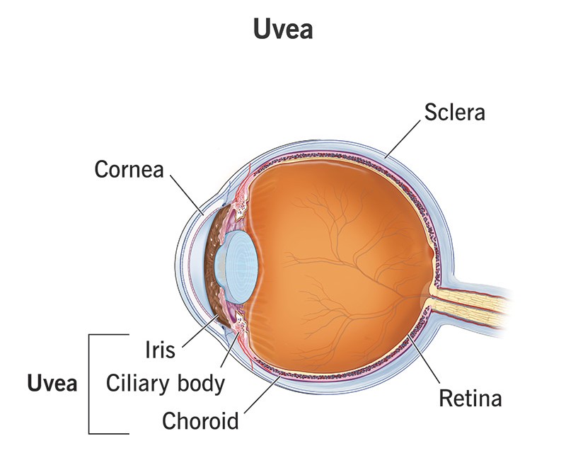 Glaucoma eye diagram